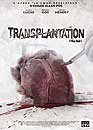 DVD, Transplantation sur DVDpasCher